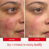 First Aid Beauty Ultra Repair Cream 56.7g
